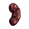 Infected Kidney